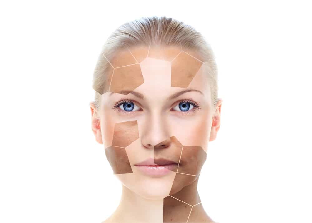 LED Face Mask and Melasma A Bright Solution or a Risky Illusion?